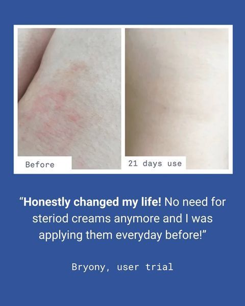 Інтенсивний зволожуючий бальзам для тіла Nursem Ultra Caring Body Balm NR05 фото