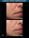 Мультипептидна сироватка з ефектом ліфтингу Allies of Skin Multi Peptides & GF Advanced Lifting Serum, 7 ml AOS16 фото 8