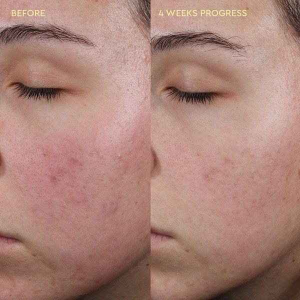 Зволожуючий гель-крем Byoma Blemish Control Moisturiser BM29 фото