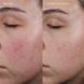 Зволожуючий гель-крем Byoma Blemish Control Moisturiser BM29 фото 4
