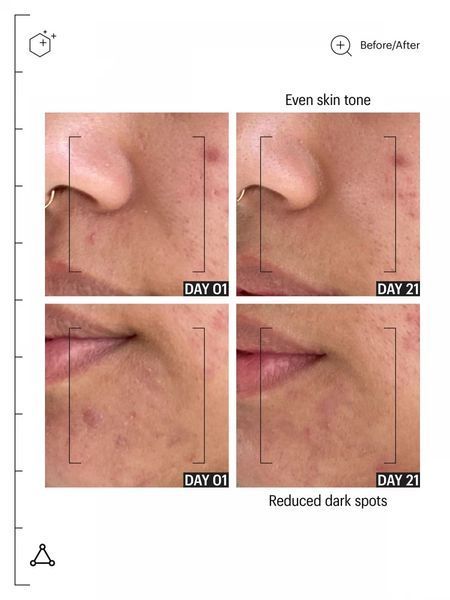Освітлююча сироватка Allies of Skin Tranexamic & Arbutin Advanced Brightening Serum AOS05 фото