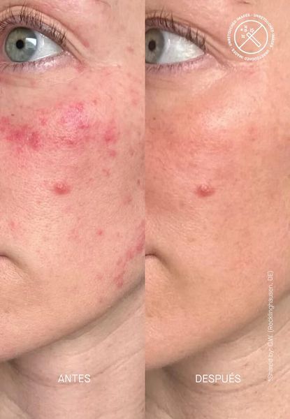 Відновлююча сироватка для обличчя з керамідами Theramid Ceramide Treatment, 10 ml TH07 фото