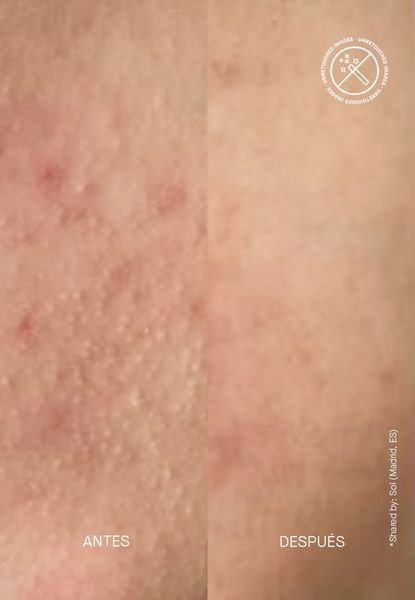 Cірчана маска Acnemy Zitmask Anti-blemish Sulfur Mask AC14 фото