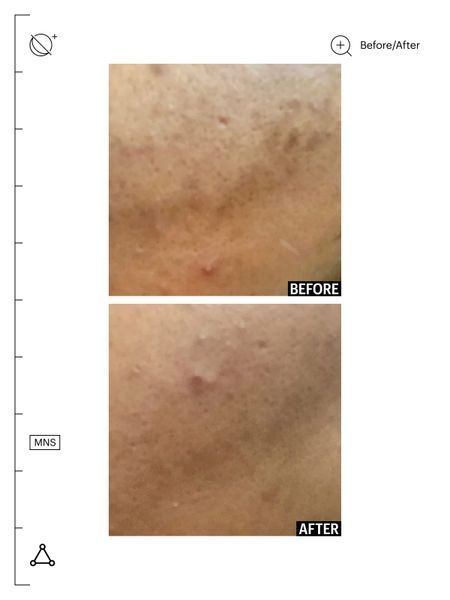 Нічна сироватка для обличчя Allies of Skin Mandelic Pigmentation Corrector Night Serum AOS15 фото