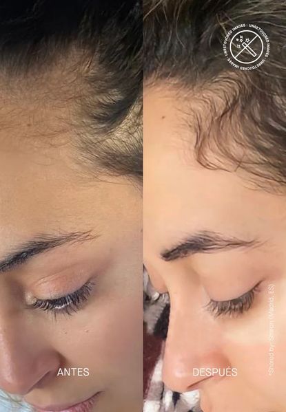 Спрей проти випадіння волосся Transparent Lab Hair Density Scalp Treatment TL22 фото